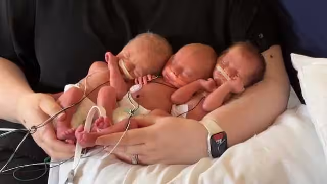4 sets of triplets born at hospital in Pittsburgh